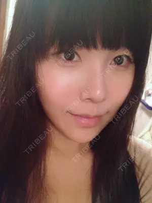 60 days after image