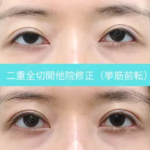 30 days after image