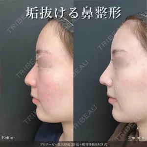 90 days after image