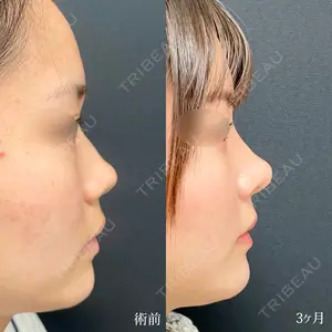 90 days after image