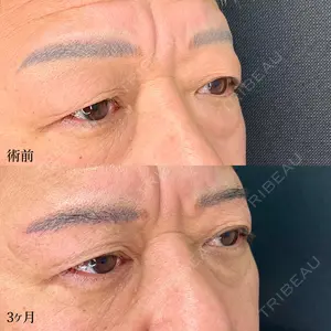 90 days after image