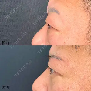 90 days after image