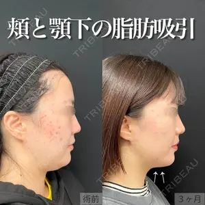 90 days after image