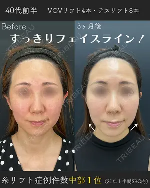 90 days after image