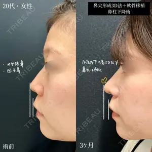 90 days after image