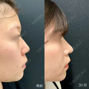 90 days after image