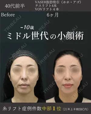 180 days after image