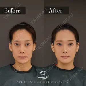 180 days after image