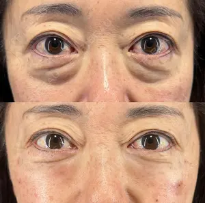 30 days after image