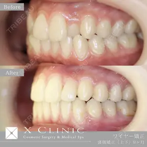 before image
