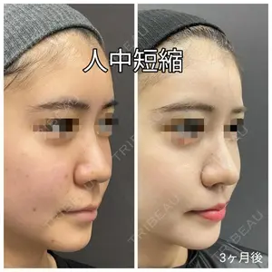 90 days after image