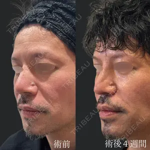 30 days after image