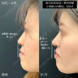 90 days after image