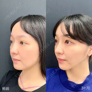 90 days after image