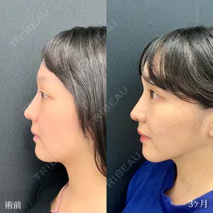 90 days after image