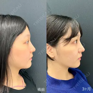 90 days after image