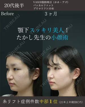 90 days after image