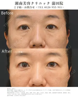 90 days after image