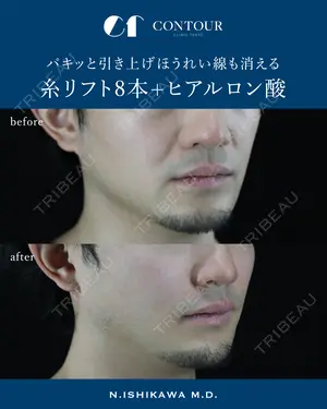 0 days after image