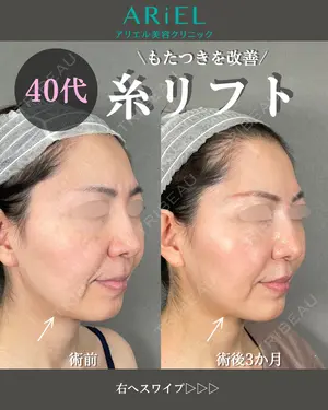 30 days after image