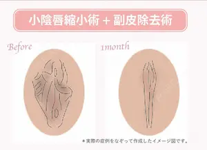 30 days after image