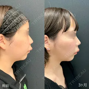 90 days after image