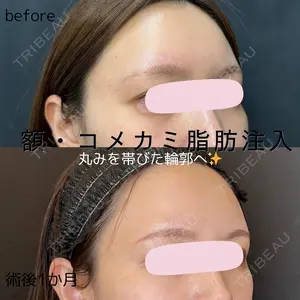 30 days after image