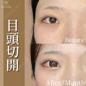 90 days after image