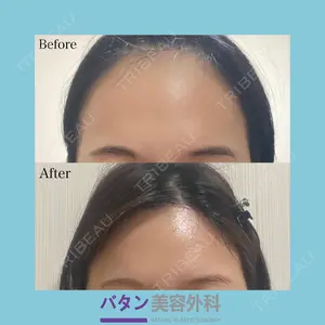 150 days after image