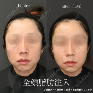 30 days after image