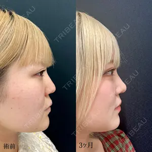 90 days after image