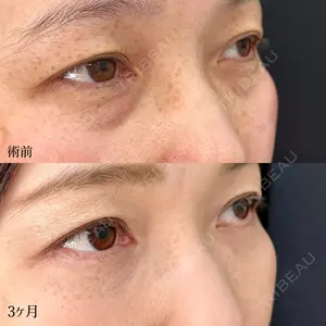 90 days after image