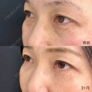 90 days after image