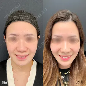 90 days after image