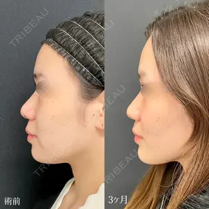 90 days after image