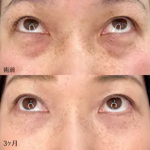 90 days after image