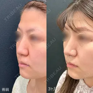 90 days after image