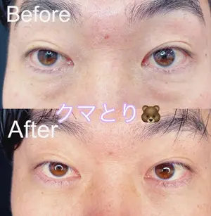 30 days after image