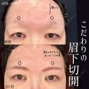 90 days after image