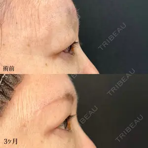 90 days after image