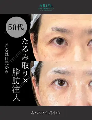 90 days after image