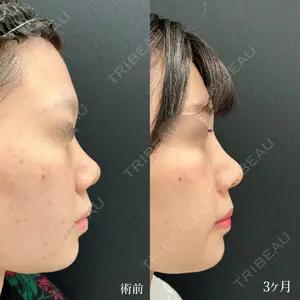 90 days after image