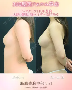 90 days after image