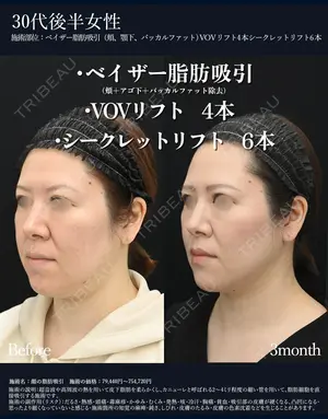 90 days after image