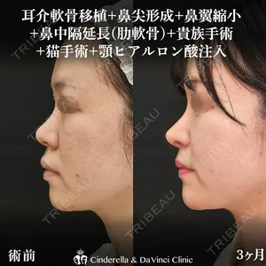 90 days after image