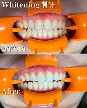 before image