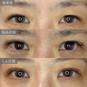 30 days after image
