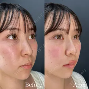 0 days after image