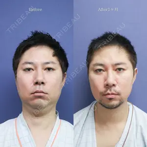 30 days after image