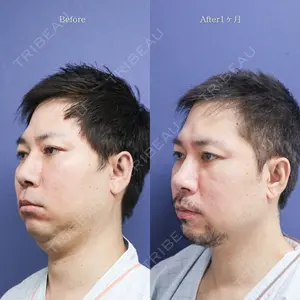 before image
